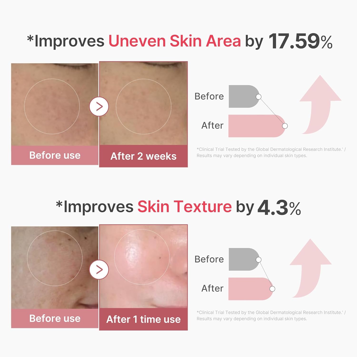 Exosome Shot PDRN Pink Collagen 2,000 PPM Spicule Facial Serum | Liquid Skin Booster | Exosome, Salmon DNA Spicules | Uneven Skin Tone, Pore Care, Skin Texture | Korean Skincare, 1.01 Fl.Oz